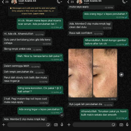 Masalah Parut Jerawat Berlubang Seminggu lebih je Parut jerawat yang berlubang tu dah start hilang — Confident bila member cakap muka clear dari dulu — Confirm repeat order.